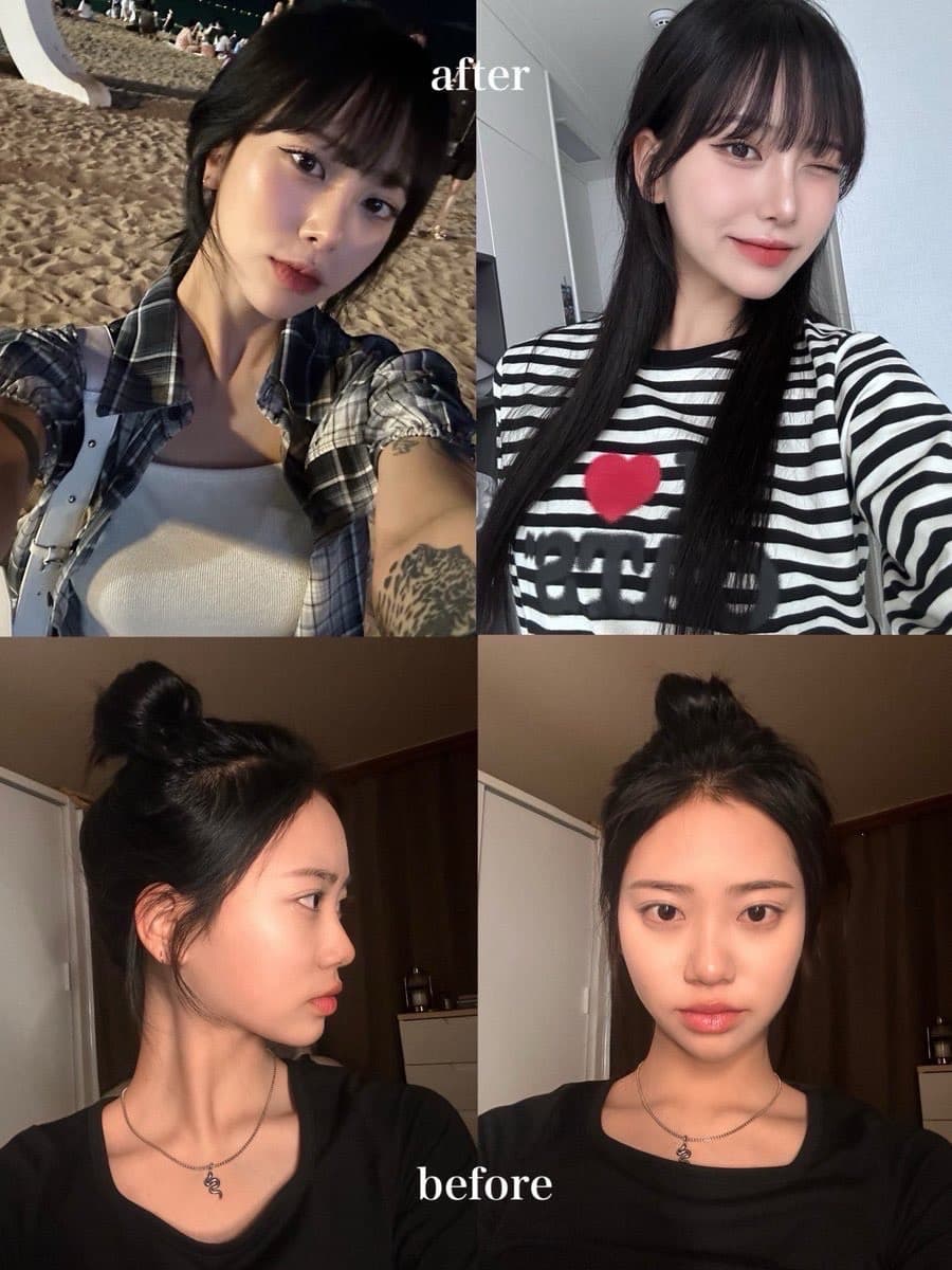 韓国鼻整形 リアルセルフィー before after ティアナ